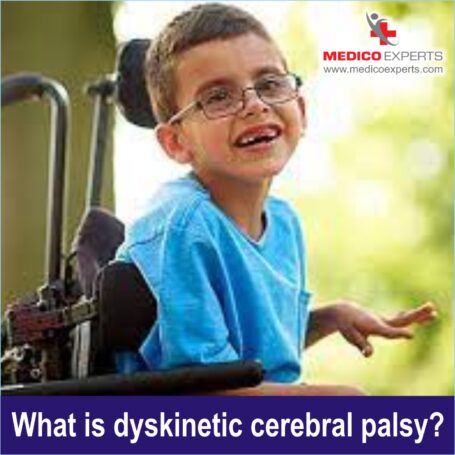 Proactive Treatment For Dyskinetic Cerebral Palsy