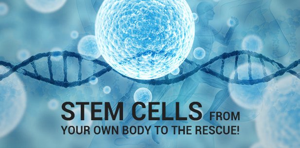 Stemcell therapy in India
