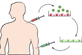 Autologous Bone Marrow Transplant