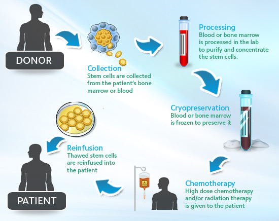 BMT procedure