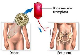 SICKLE CELL ANAEMIA TREATMENT