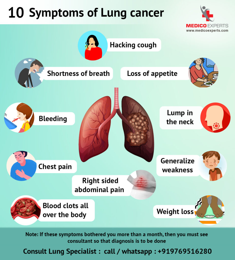 10 Symptoms Of Lung Cancer - Medicoexperts