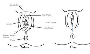 Cosmetic Surgery in Nigeria | MedicoExperts