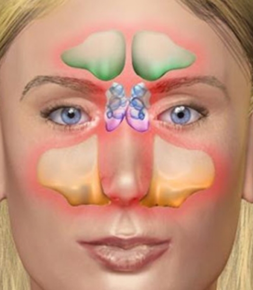 Nose and Sinus Disorders in India