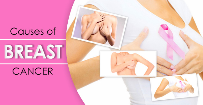 causes of breast cancer