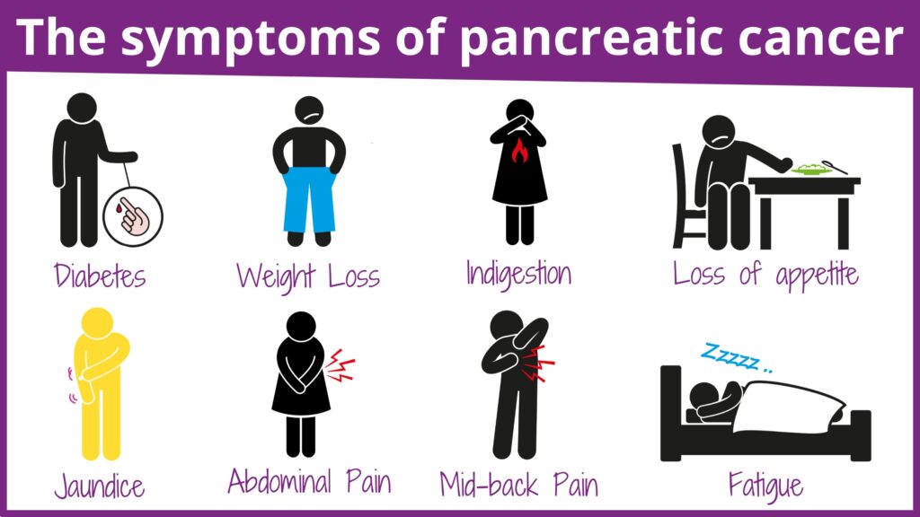 Best Pancreatic cancer treatment in India with highest success rates