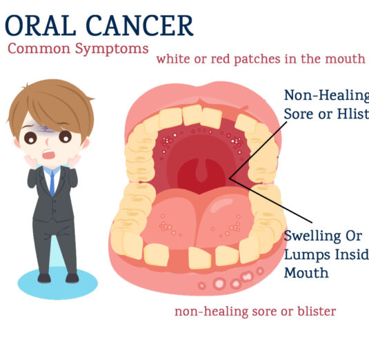 Oral cancer treatment in India | Highest survival rates