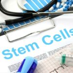 stem-cells therapy for knee pain