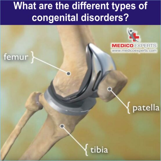 Different types of congenital disorders