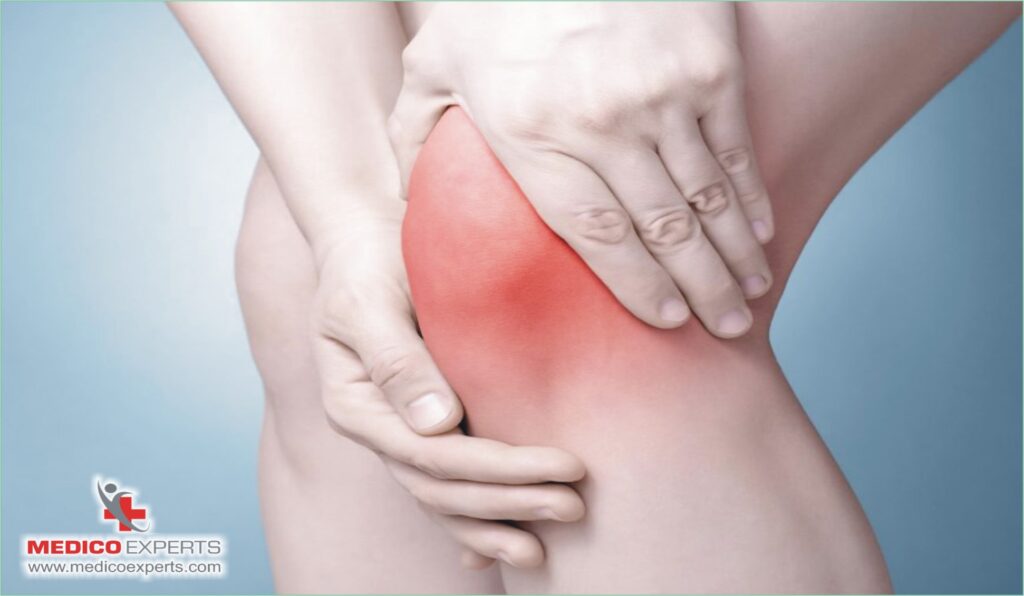 Are you a good candidate for stem cell therapy?

latest knee arthritis treatment

best knee arthritis treatment

What is the best way to treat arthritis in the knee?