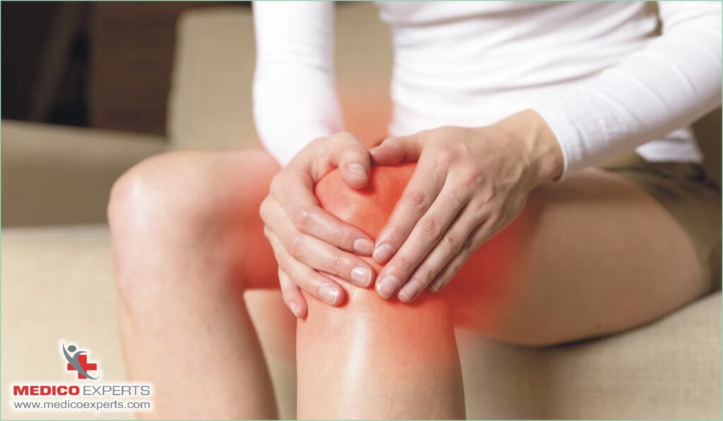 knee arthritis treatment without surgery - Takeaway

knee arthritis treatment without surgery in india

Can arthritis in the knee be removed?