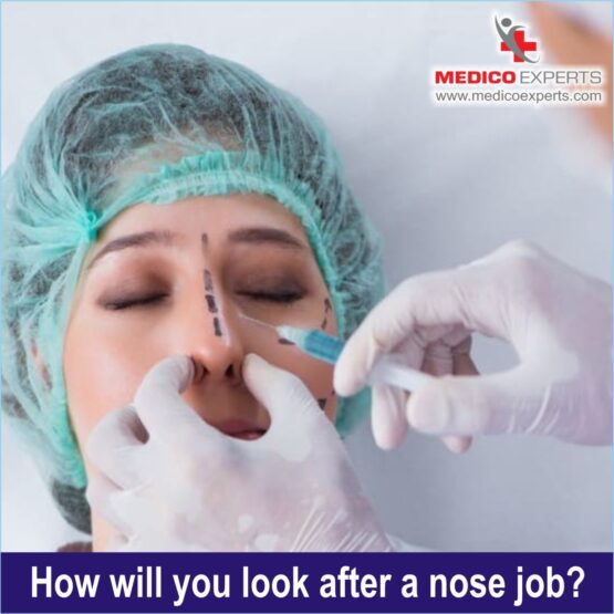 Rhinoplasty Surgery in india