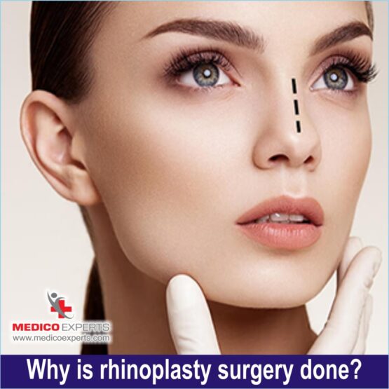 Rhinoplasty Surgery, Why is rhinoplasty surgery done?