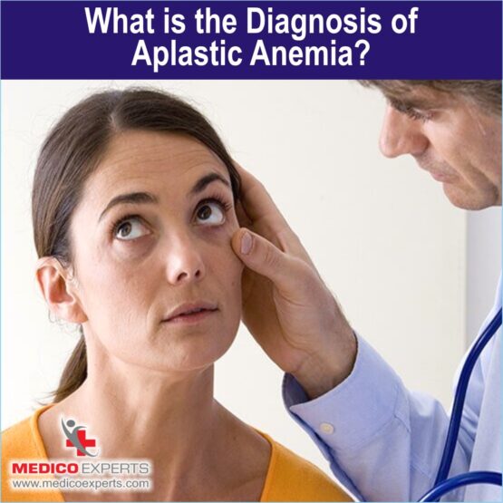 What is the diagnosis of Aplastic Anemia?