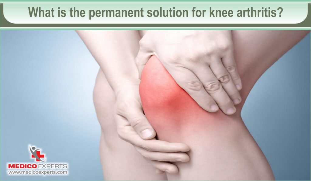 Knee arthritis treatment without surgery is now possible