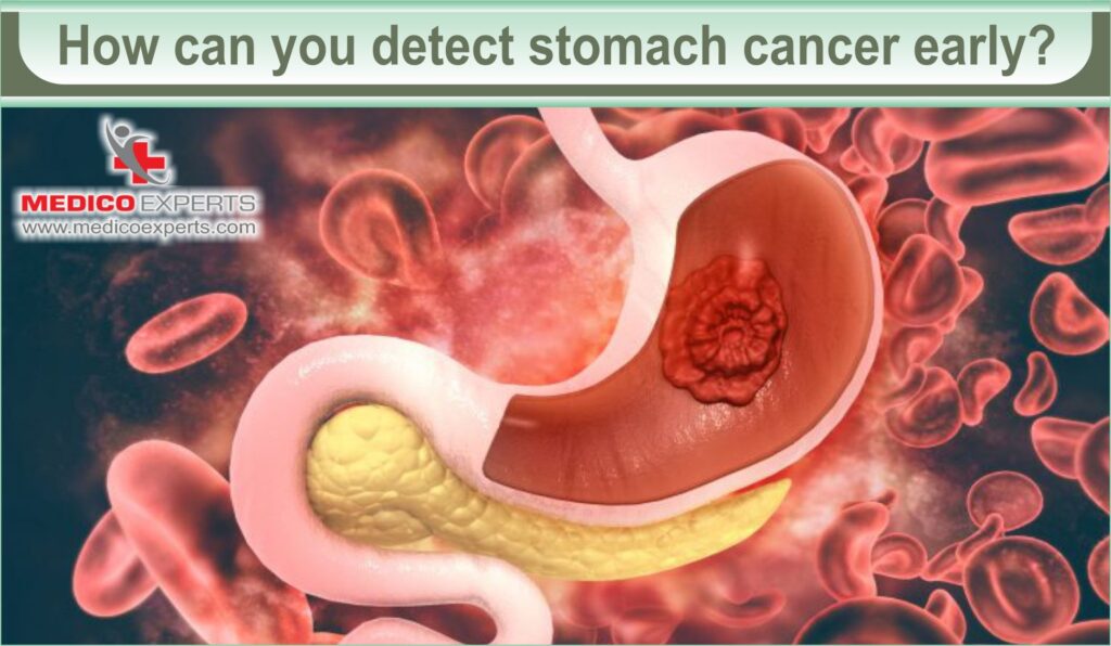 is stomach cancer curable in india