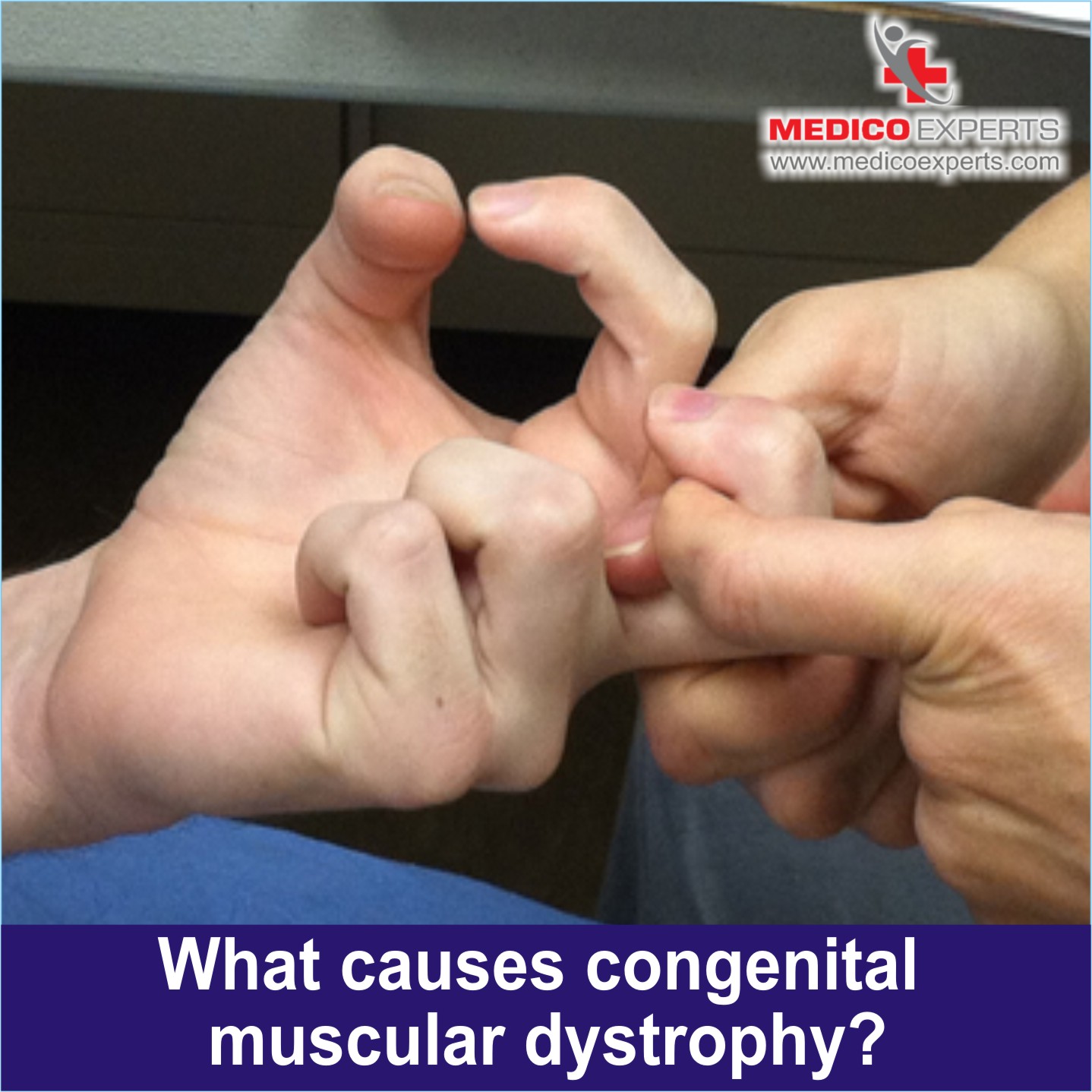 Causes of Congenital Muscular Dystrophy, Congenital Muscular Dystrophy treatment in India