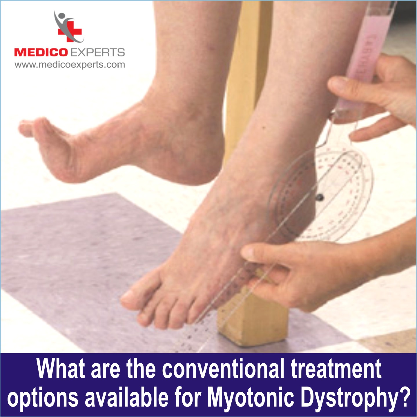 Conventional Treatment options for Myotonic Dystrophy