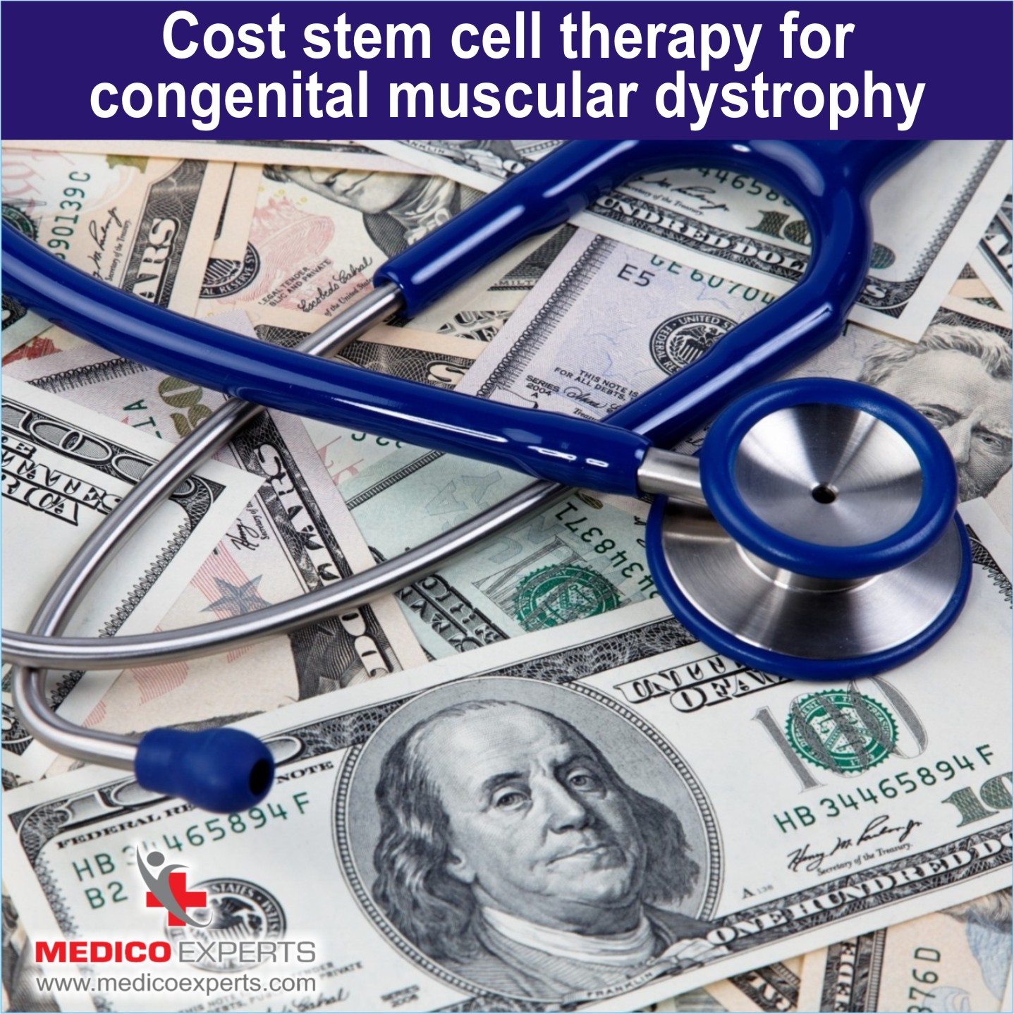 Cost of Stem cell therapy for Congenital Muscular Dystrophy in India