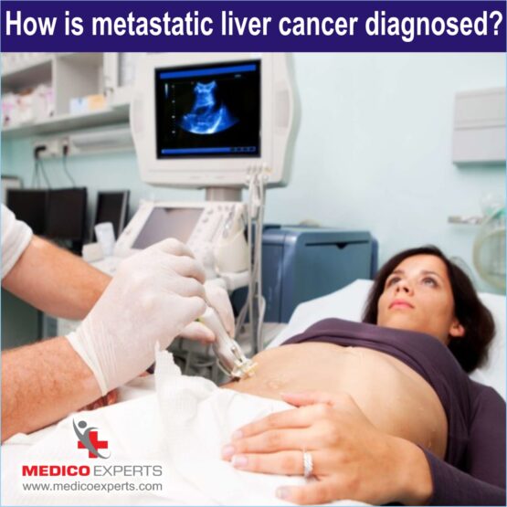 Diagnosis of Metastatic Liver Cancer