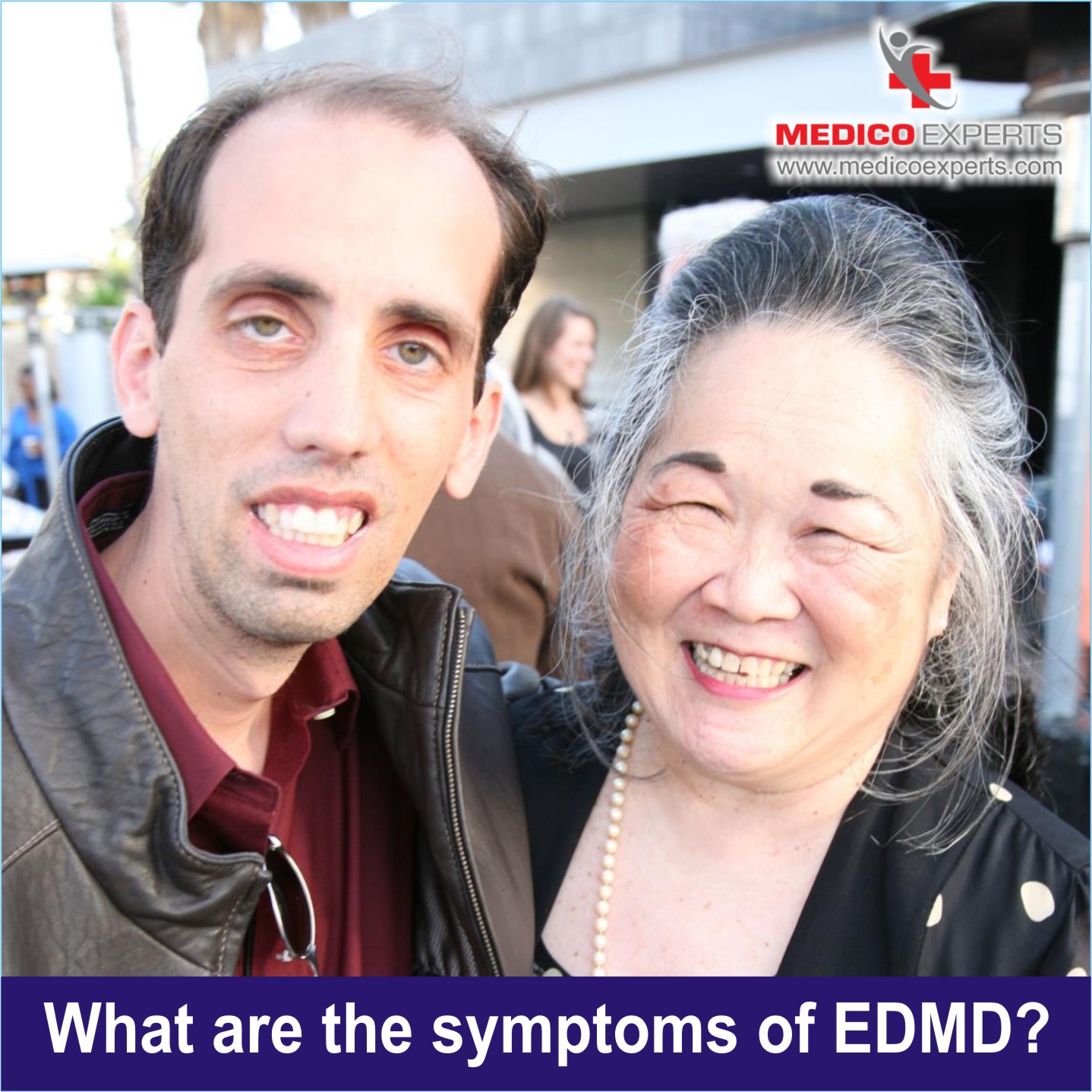 Emery Dreifuss Muscular Dystrophy Symptoms