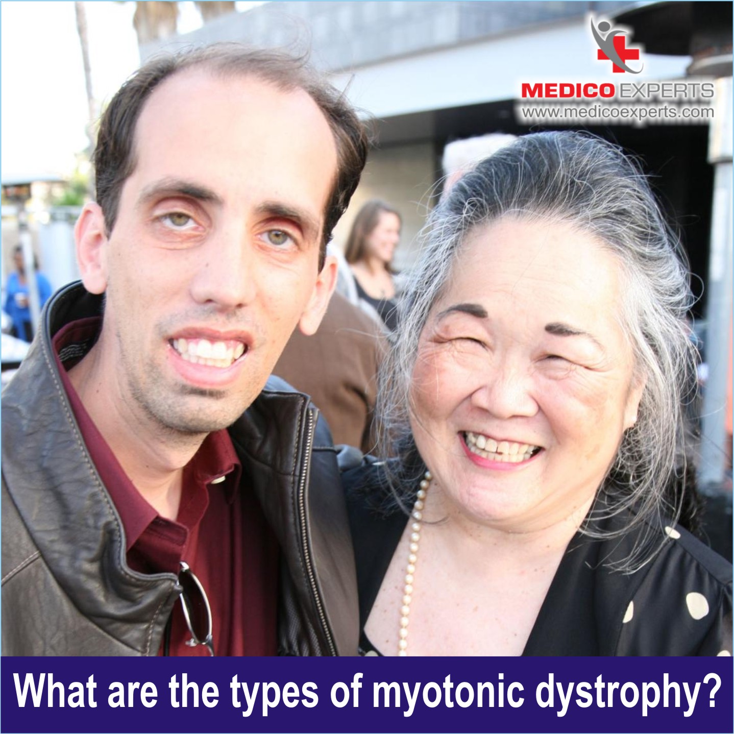 Myotonic Dystrophy Types