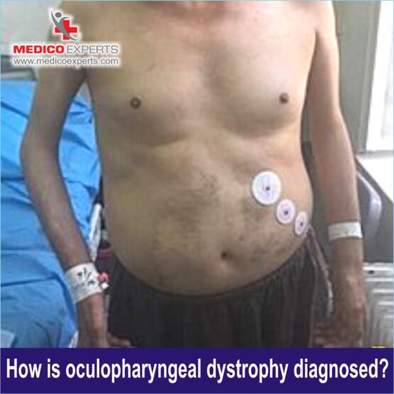 Oculopharyngeal Muscular Dystrophy