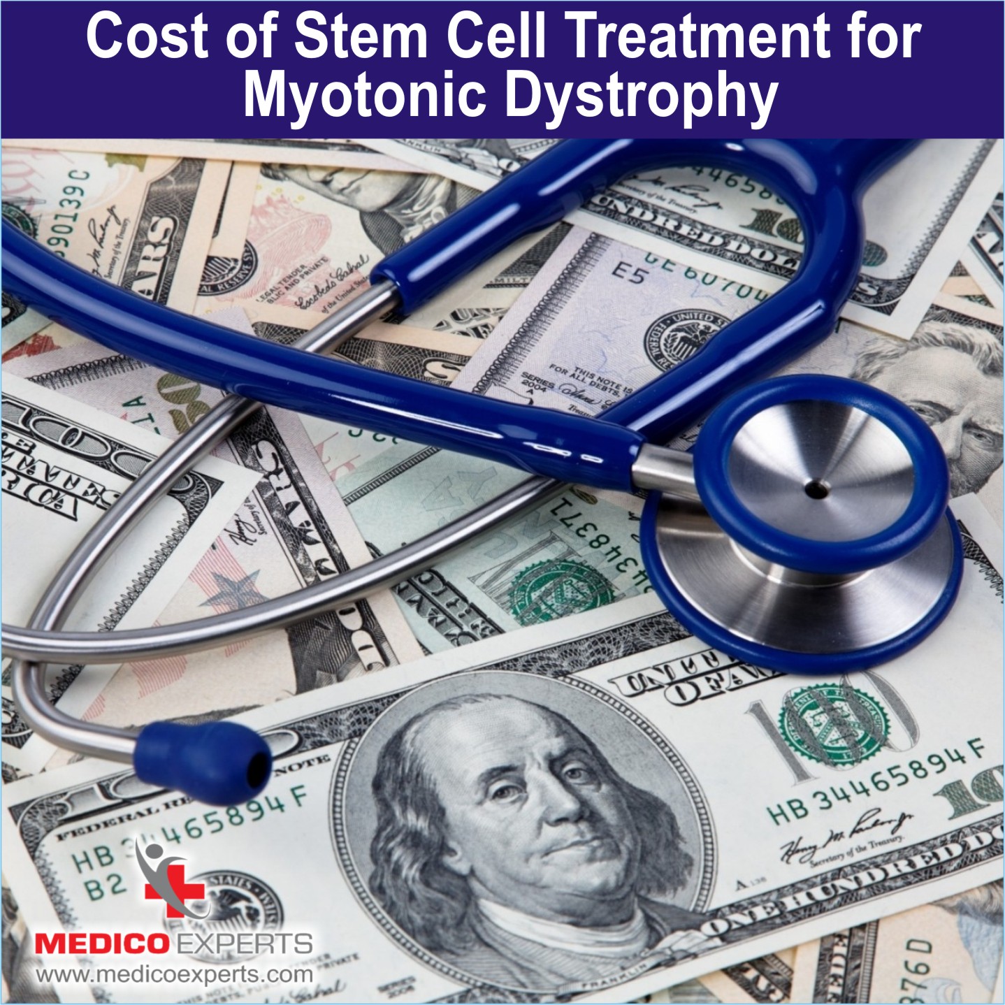 Stem cell cost for Myotonic Dystrophy treatment in India