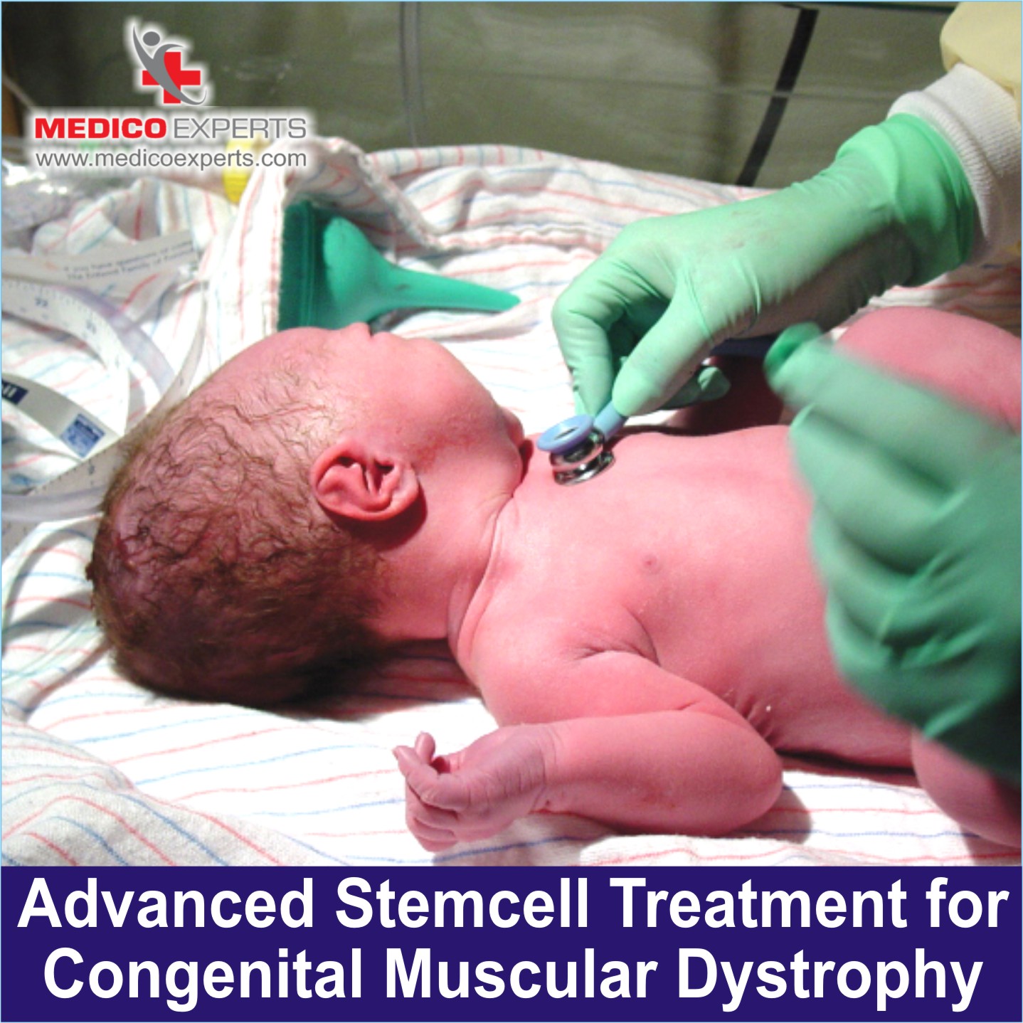 Stem cell therapy for Congenital Muscular Dystrophy