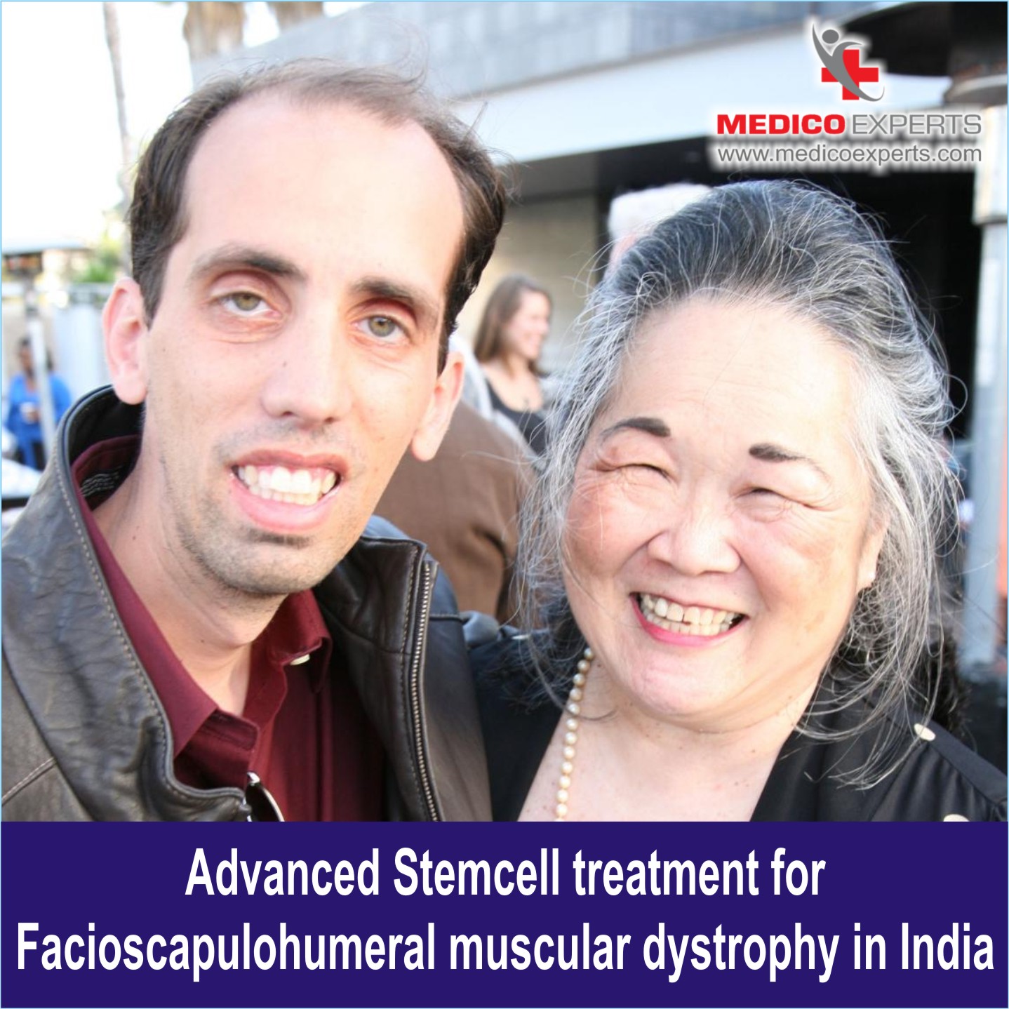 Stem cell therapy for Facioscapulohumeral Muscular Dystrophy in India