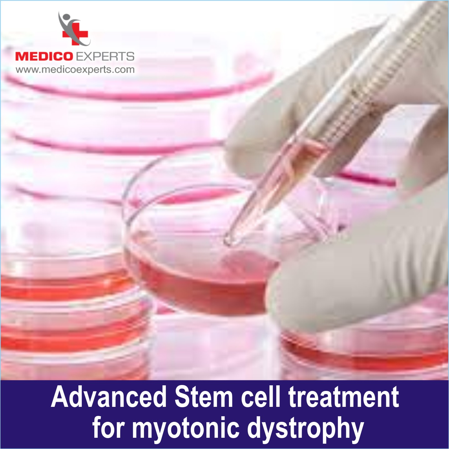 Stem cell therapy for Myotonic Dystrophy in India