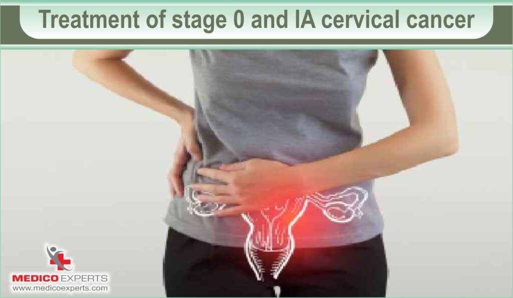 cervical cancer stages and treatment