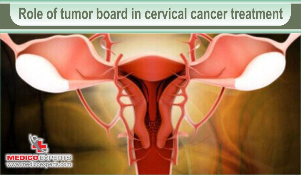 cervical cancer stages and treatment | MedicoExperts