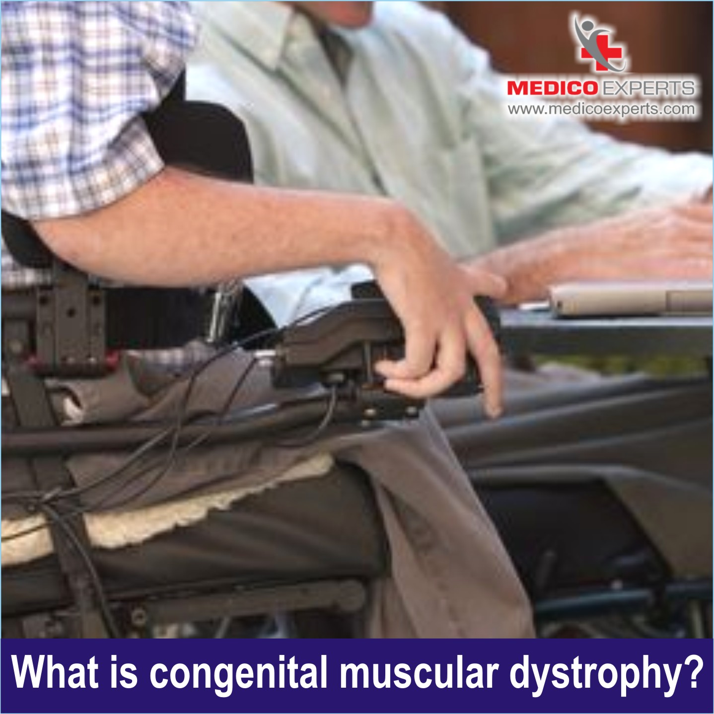 What is Congenital Muscular Dystrophy