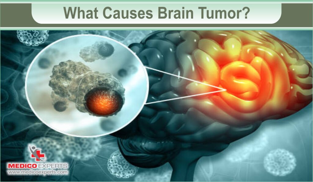 brain tumor symptoms