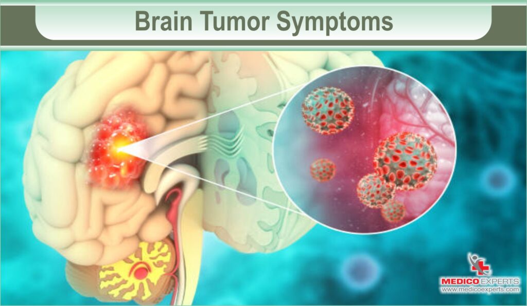 brain tumor symptoms