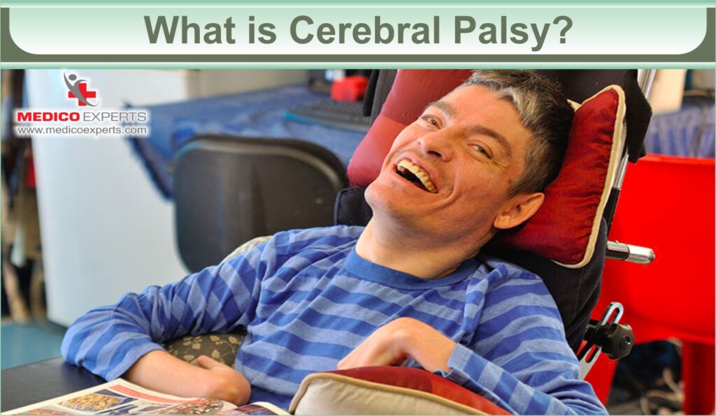 6 Best Foods For Cerebral Palsy To Optimize Development