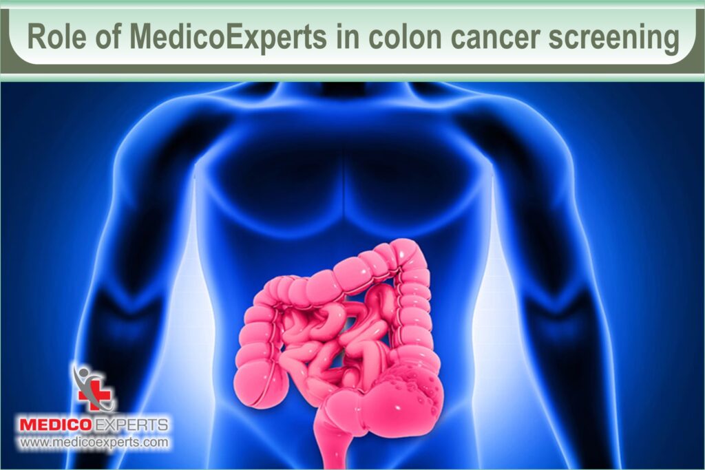 colon cancer signs and symptoms | MedicoExperts