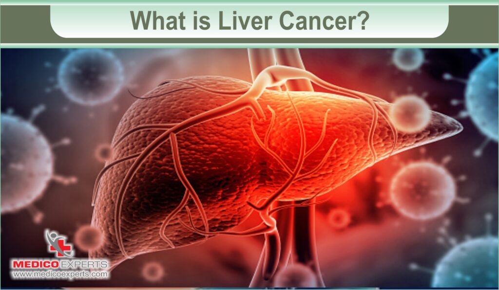 can-liver-cancer-be-cured-regular-localized-treatments