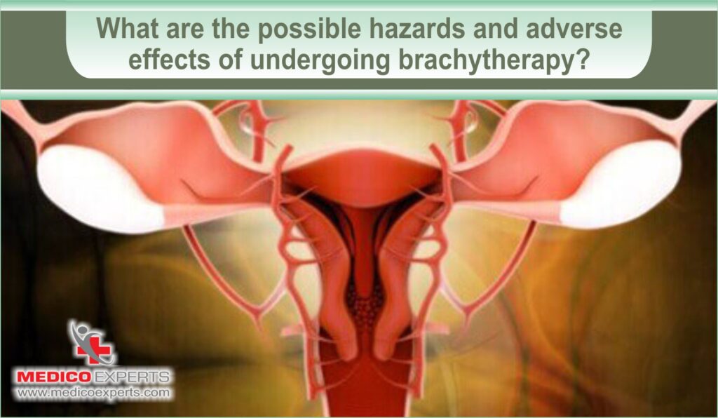 Brachytherapy Cervical Cancer