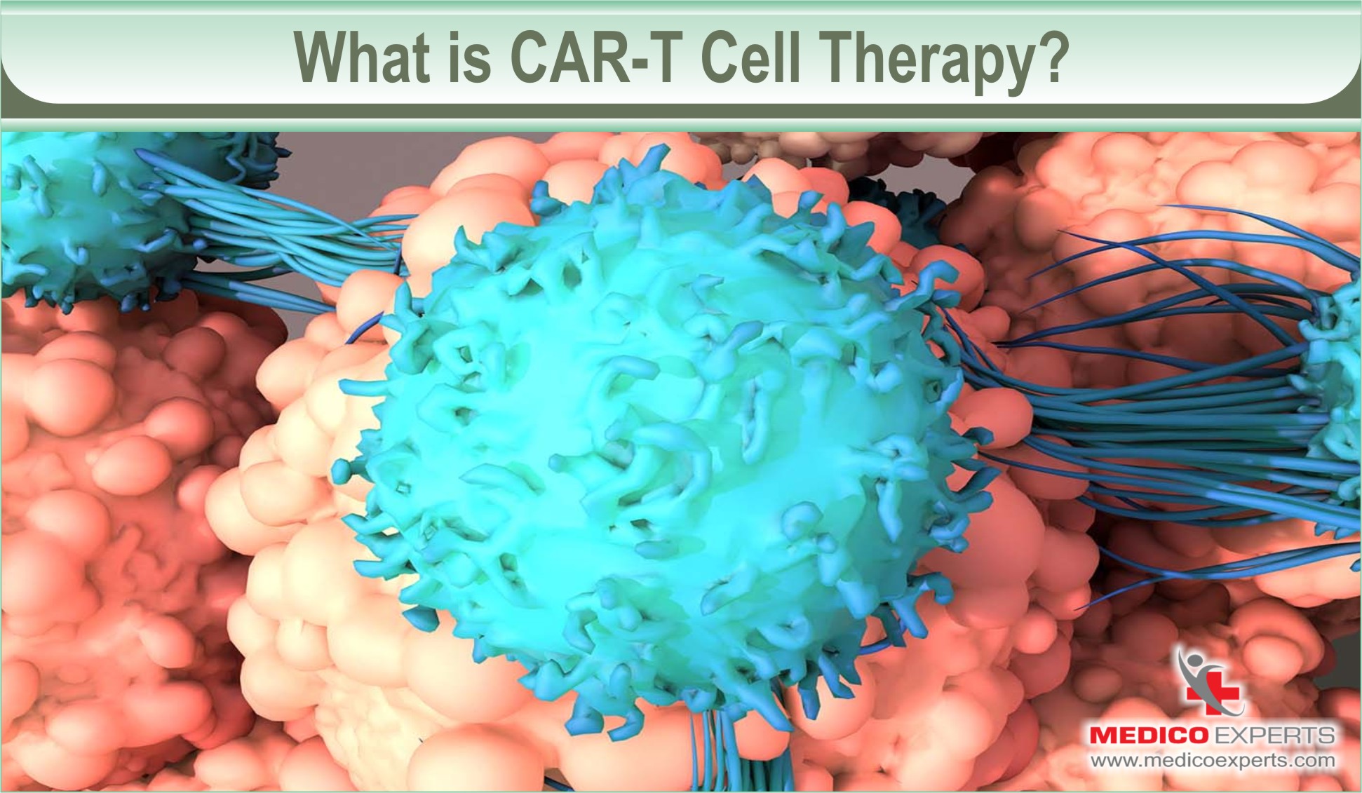 Hope For Patients With Cancer: Car T-Cell Therapy In India