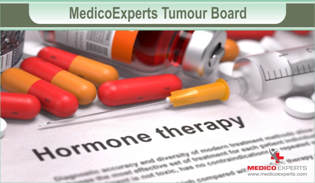 hormone therapy for cancer | MedicoExperts