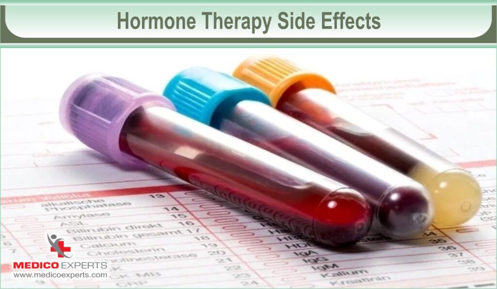 hormone therapy for cancer | MedicoExperts