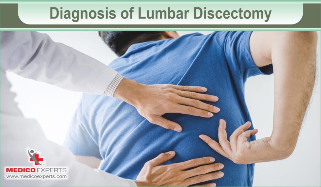 lumbar discectomy | MedicoExperts