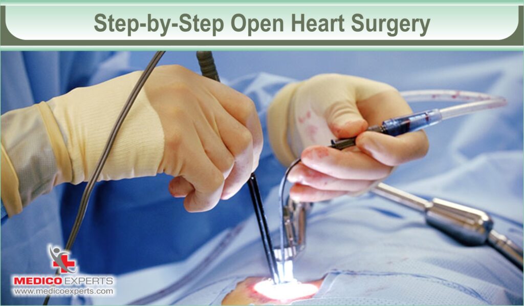 open heart surgery in india