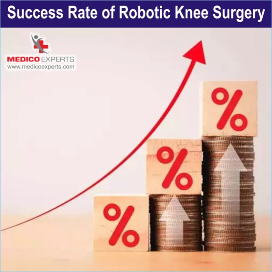 Robotic Knee Replacement