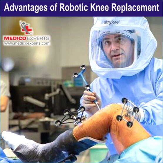 advantages of after robotic knee replacement