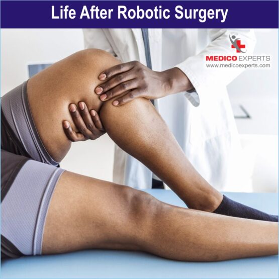 Life after robotic knee replacement