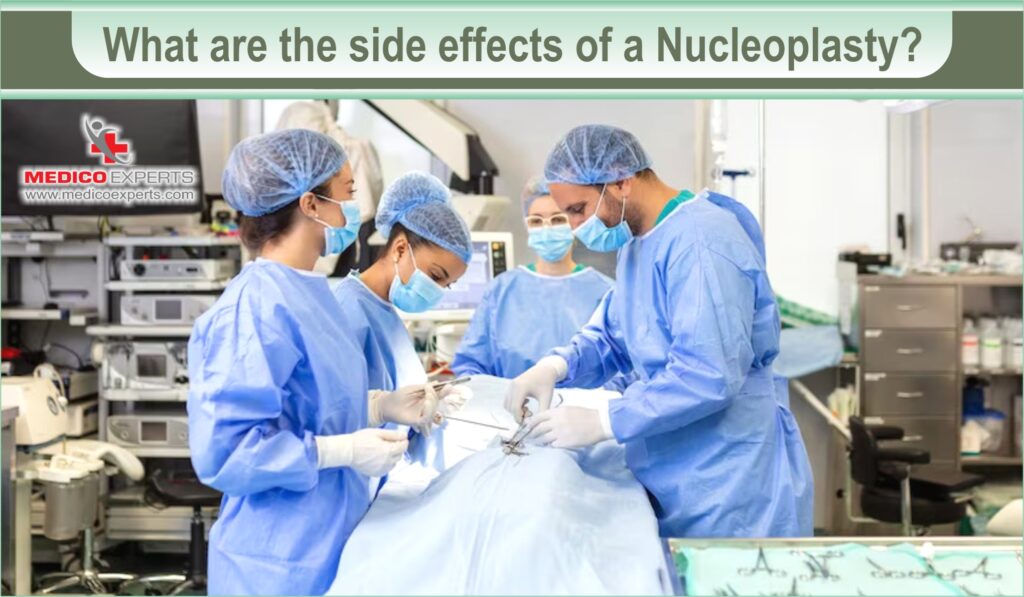 nucleoplasty | MedicoExperts