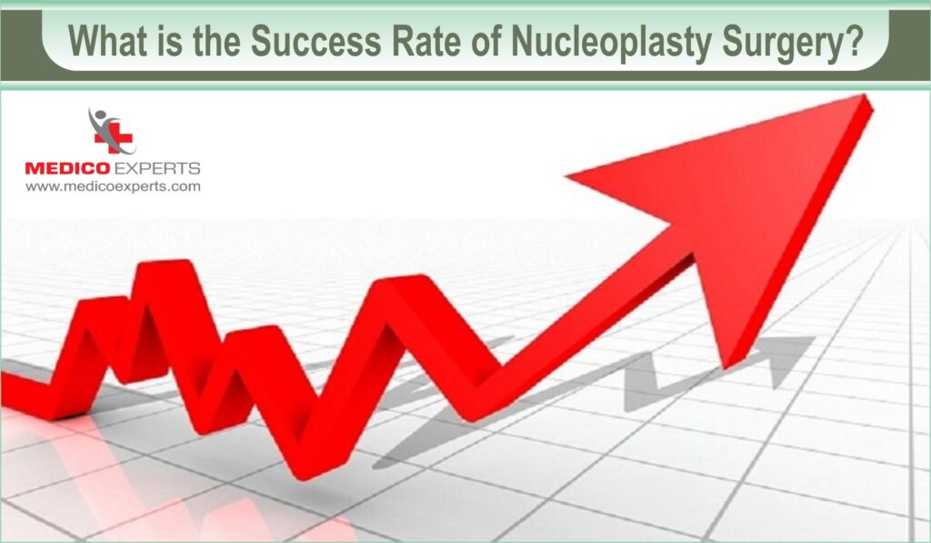 nucleoplasty | MedicoExperts